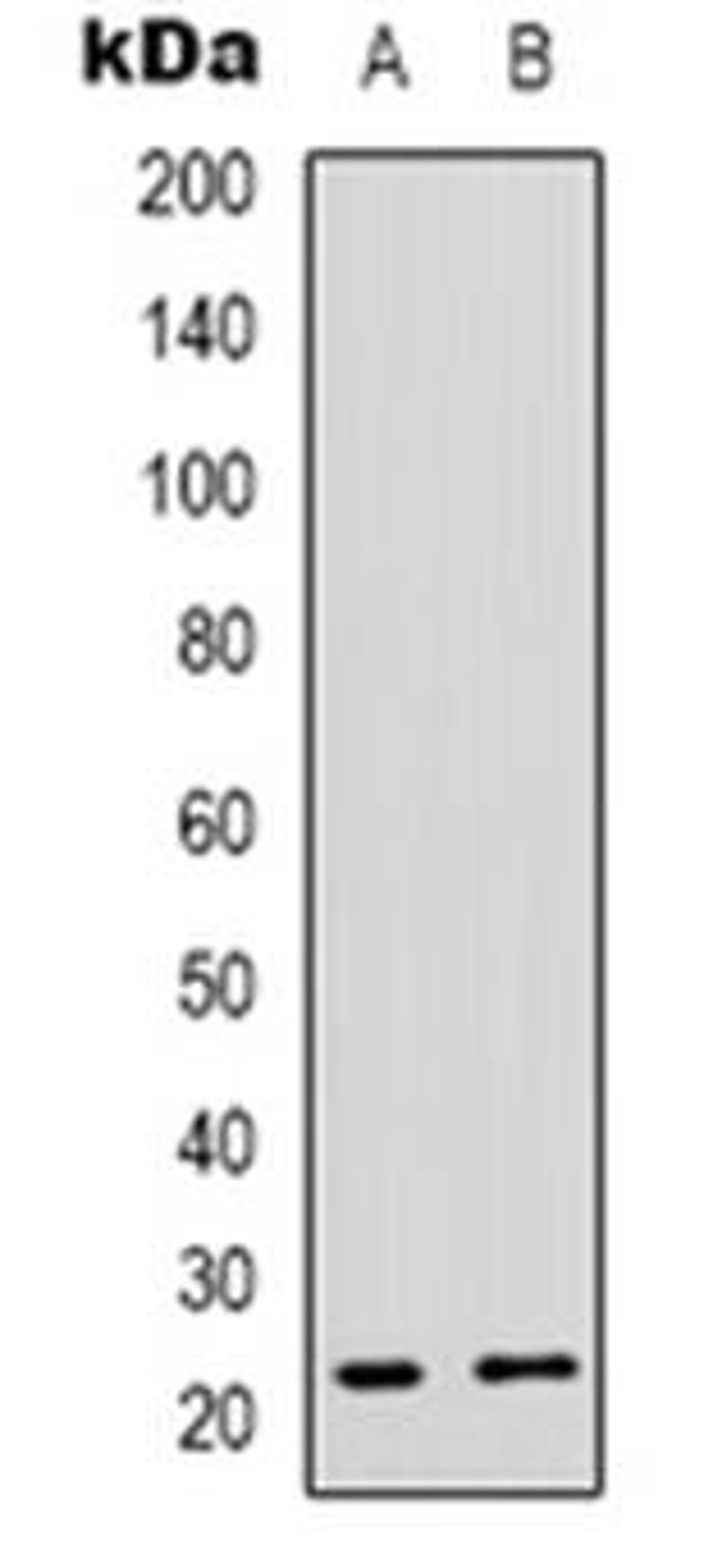 Western blot analysis of MRPL48 expression in Hela (Lane 1), Jurkat (Lane 2) whole cell lysates using MRPL48 antibody