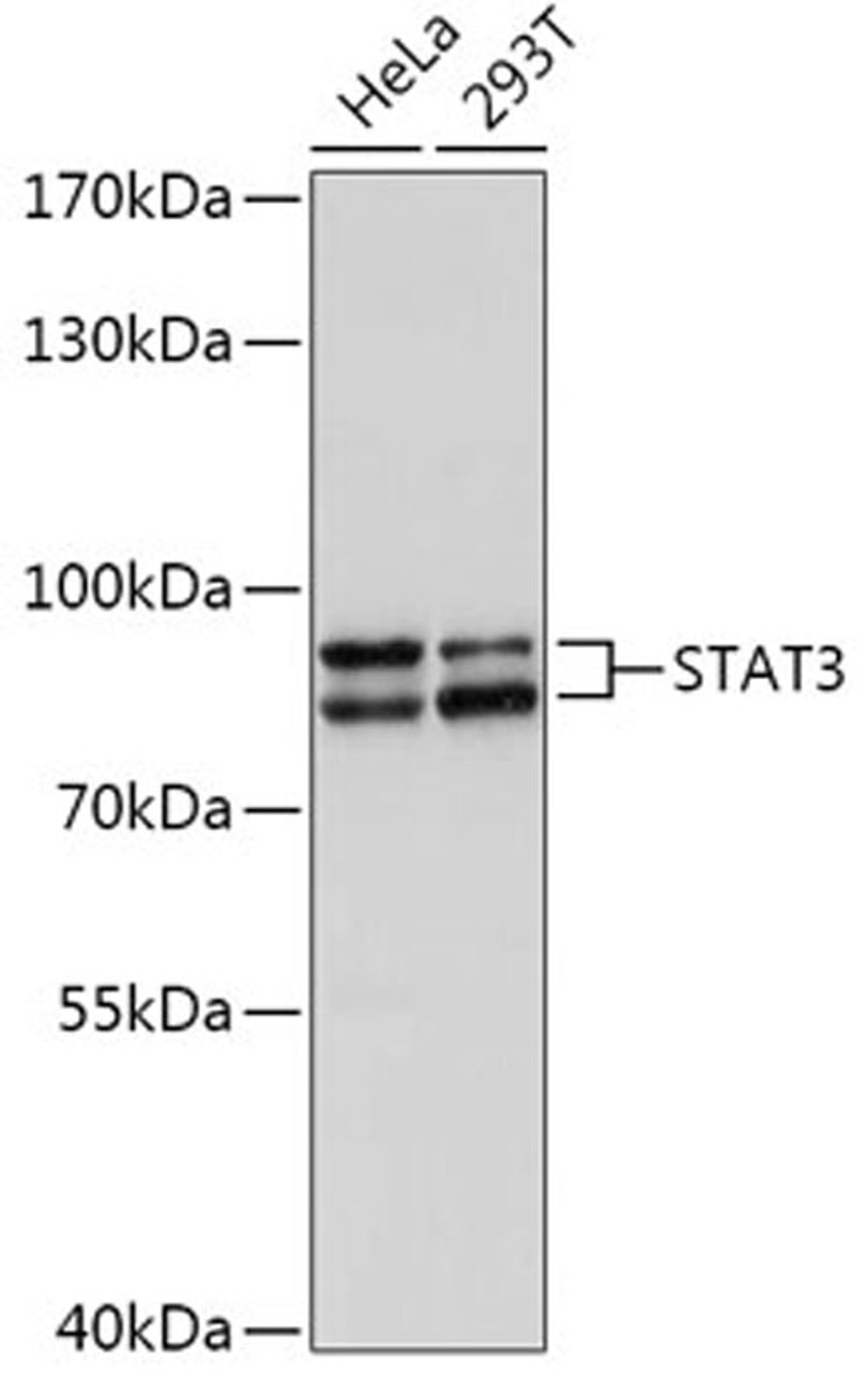 Western blot - STAT3 antibody (A1192)