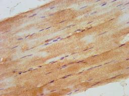 IHC image of CSB-PA745331LA01HU diluted at 1:500 and staining in paraffin-embedded human skeletal muscle tissue performed on a Leica BondTM system. After dewaxing and hydration, antigen retrieval was mediated by high pressure in a citrate buffer (pH 6.0). Section was blocked with 10% normal goat serum 30min at RT. Then primary antibody (1% BSA) was incubated at 4&deg;C overnight. The primary is detected by a biotinylated secondary antibody and visualized using an HRP conjugated SP system.