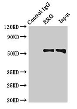Immunoprecipitating ERG in Rat heart tissue. Lane 1: Rabbit control IgG (1µg) instead of CSB-PA007781HA01HU in Rat heart tissue. For western blotting, a HRP-conjugated Protein G antibody was used as the secondary antibody (1/2000). Lane 2: CSB-PA007781HA01HU (8µg) + Rat heart tissue (500µg). Lane 3: Rat heart tissue (10µg)