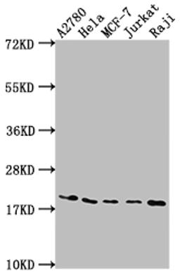 Western Blot. Positive WB detected in: A2780 whole cell lysate, Hela whole cell lysate, MCF-7 whole cell lysate, Jurkat whole cell lysate, Raji whole cell lysate. All lanes: EIF5A antibody at 1:2000. Secondary. Goat polyclonal to rabbit IgG at 1/50000 dilution. Predicted band size: 17, 21 kDa. Observed band size: 18 kDa. 