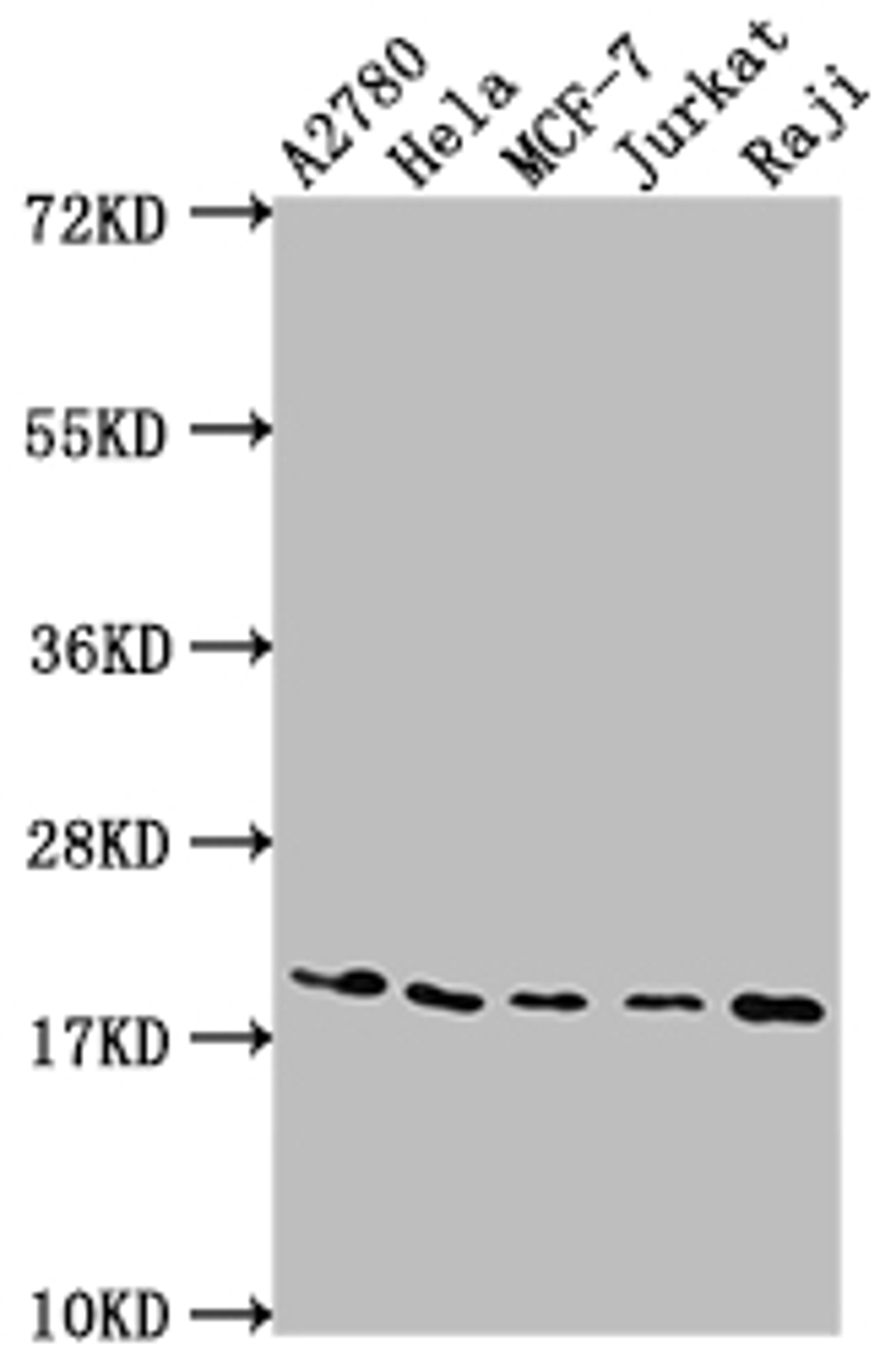 Western Blot. Positive WB detected in: A2780 whole cell lysate, Hela whole cell lysate, MCF-7 whole cell lysate, Jurkat whole cell lysate, Raji whole cell lysate. All lanes: EIF5A antibody at 1:2000. Secondary. Goat polyclonal to rabbit IgG at 1/50000 dilution. Predicted band size: 17, 21 kDa. Observed band size: 18 kDa. 