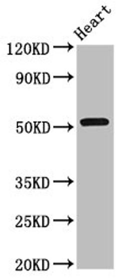 Western Blot. Positive WB detected in: Rat heart tissue. All lanes: RGS6 antibody at 8ug/ml. Secondary. Goat polyclonal to rabbit IgG at 1/50000 dilution. Predicted band size: 55, 57, 54, 50, 51, 53, 52, 41, 56 kDa. Observed band size: 55 kDa. 