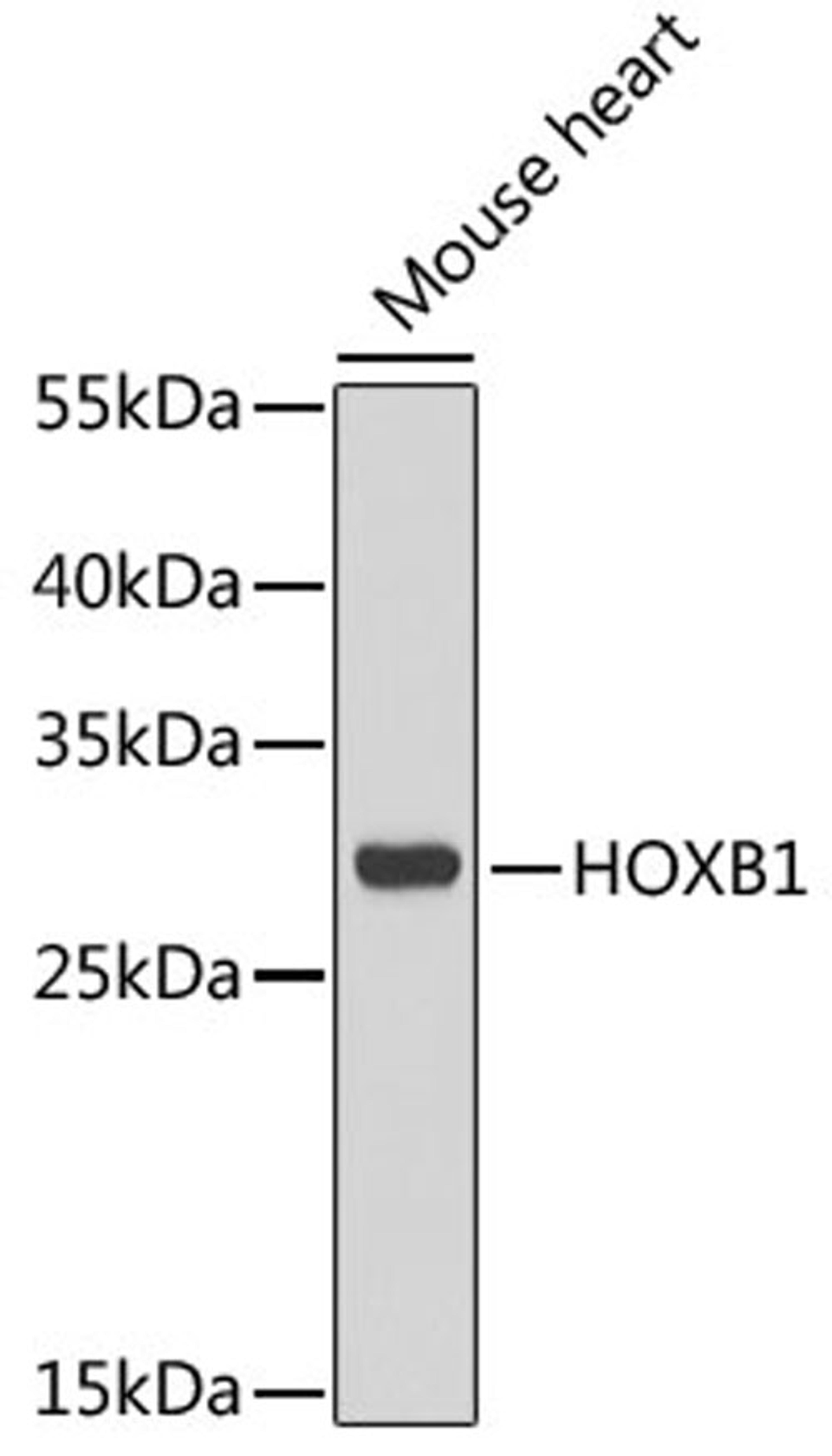 Western blot - HOXB1 antibody (A6619)