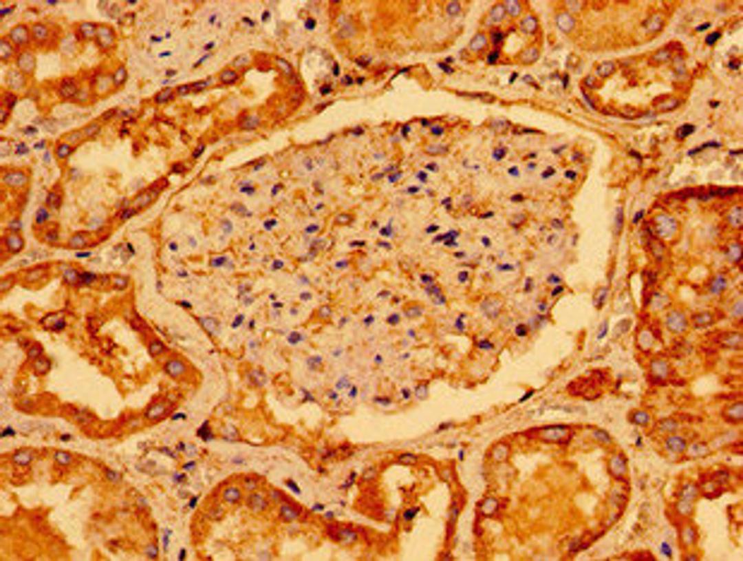 Immunohistochemistry of paraffin-embedded human kidney tissue using CSB-PA614416LA01HU at dilution of 1:100