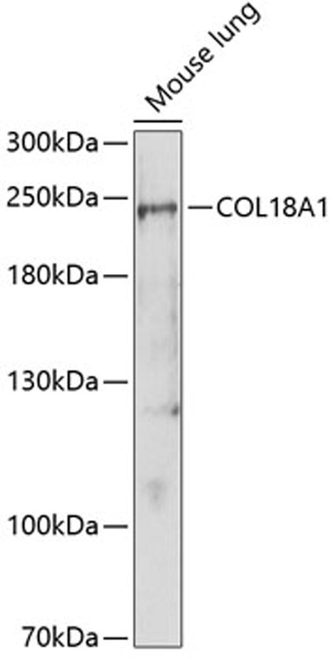 Western blot - COL18A1 antibody (A1722)