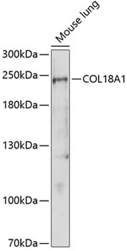 Western blot - COL18A1 antibody (A1722)