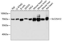 Western blot - SLC25A12 antibody (A11688)