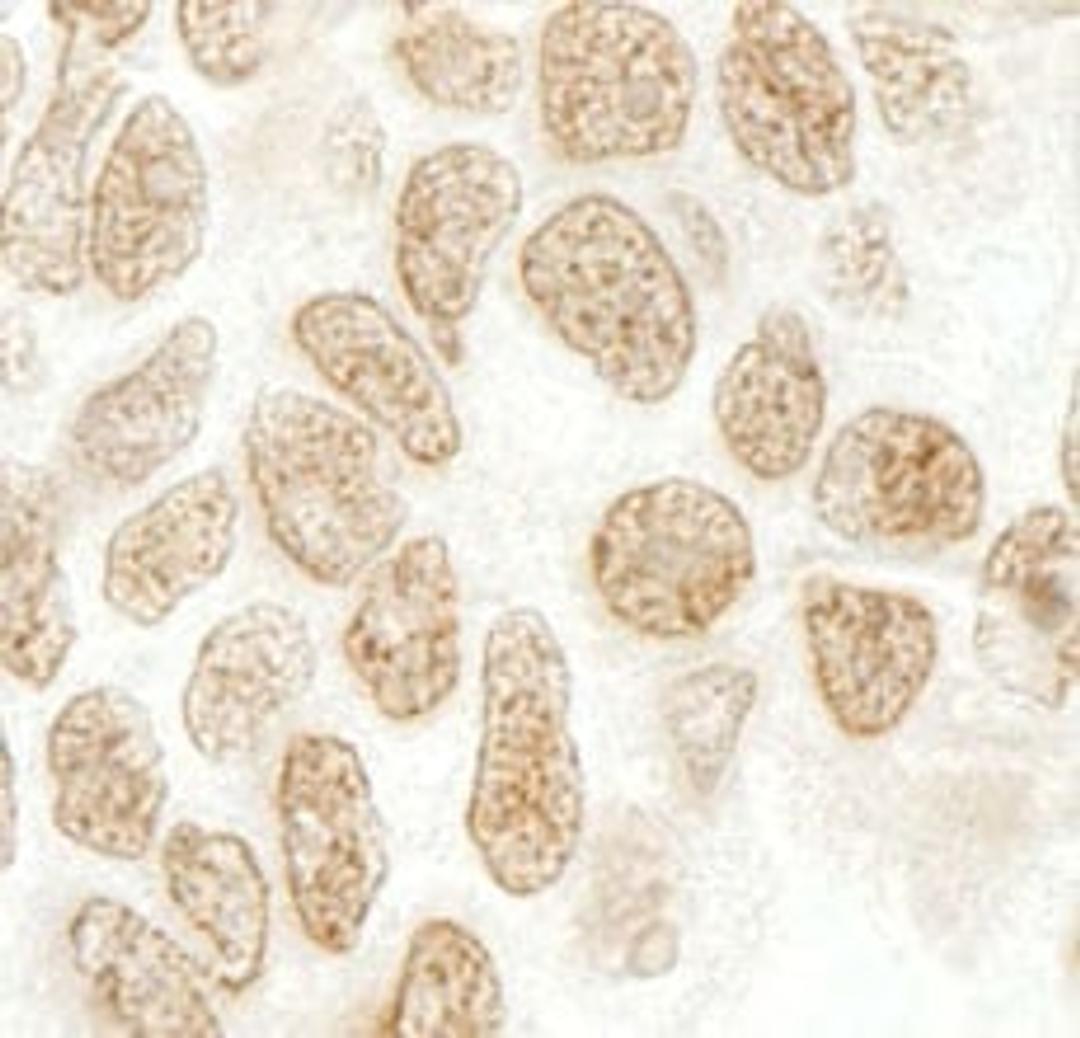 Detection of human SRcyp by immunohistochemistry.