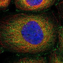 Immunocytochemistry/Immunofluorescence: Testin Antibody [NBP1-87987] - Staining of human cell line A-431 shows positivity in plasma membrane, cytoplasm & cell junctions.