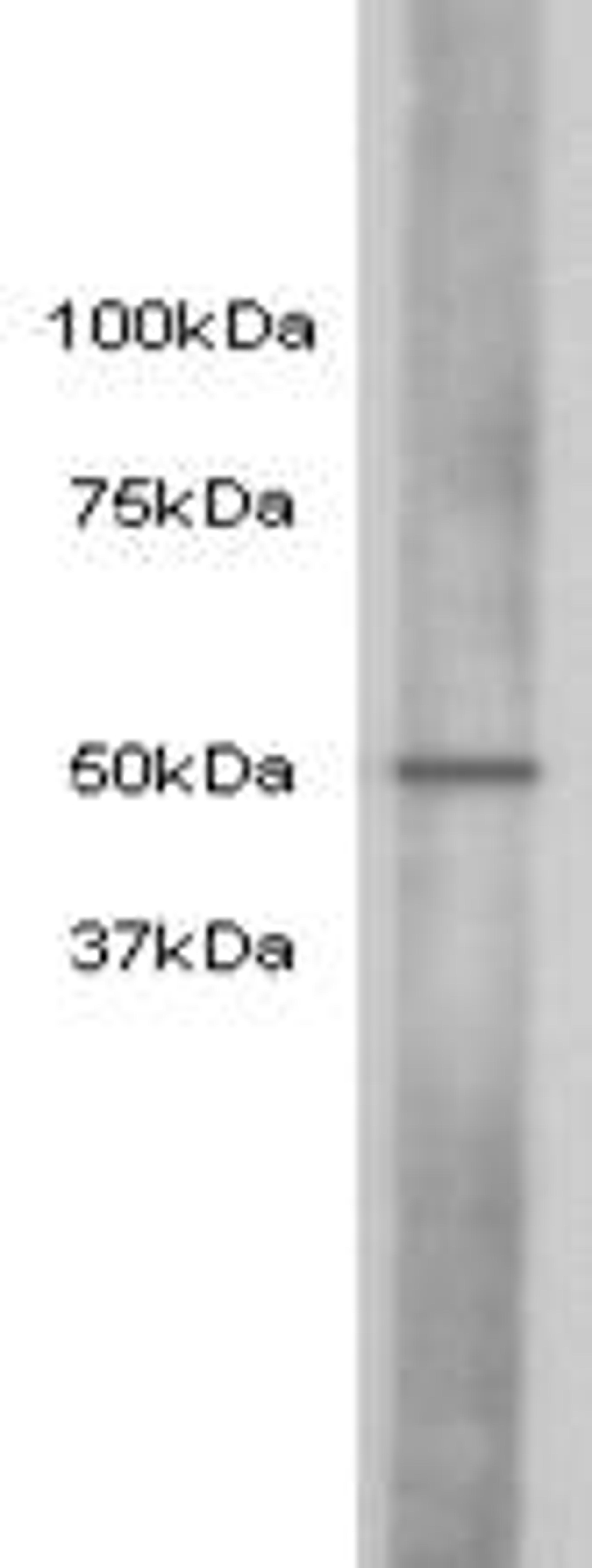 Western Blot analysis of hela using Cyclin E2 monoclonal antibody