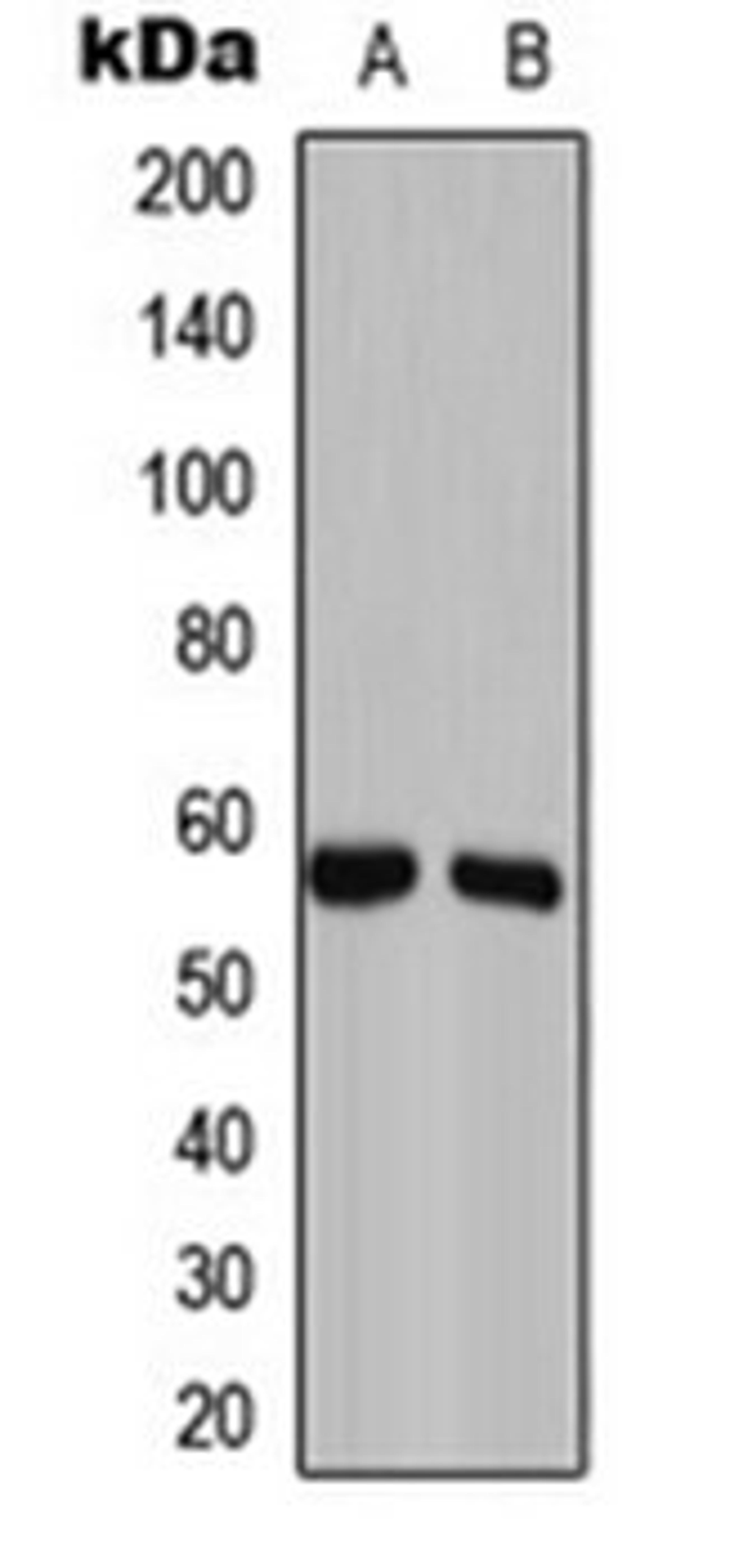 Western blot analysis of Caco2 (Lane 1), NIH3T3 (Lane 2) whole cell lysates using GAS8 antibody