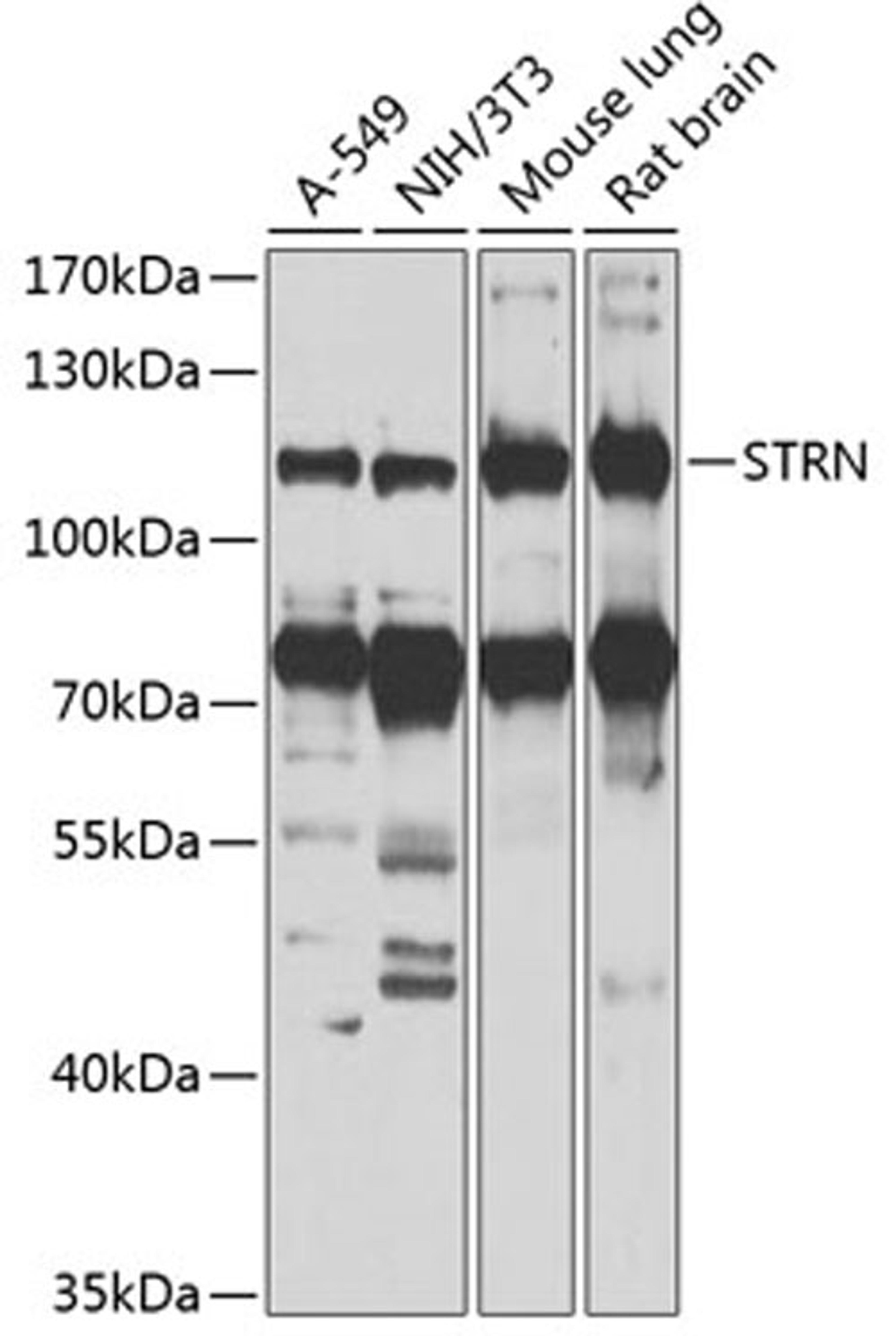 Western blot - STRN antibody (A7734)