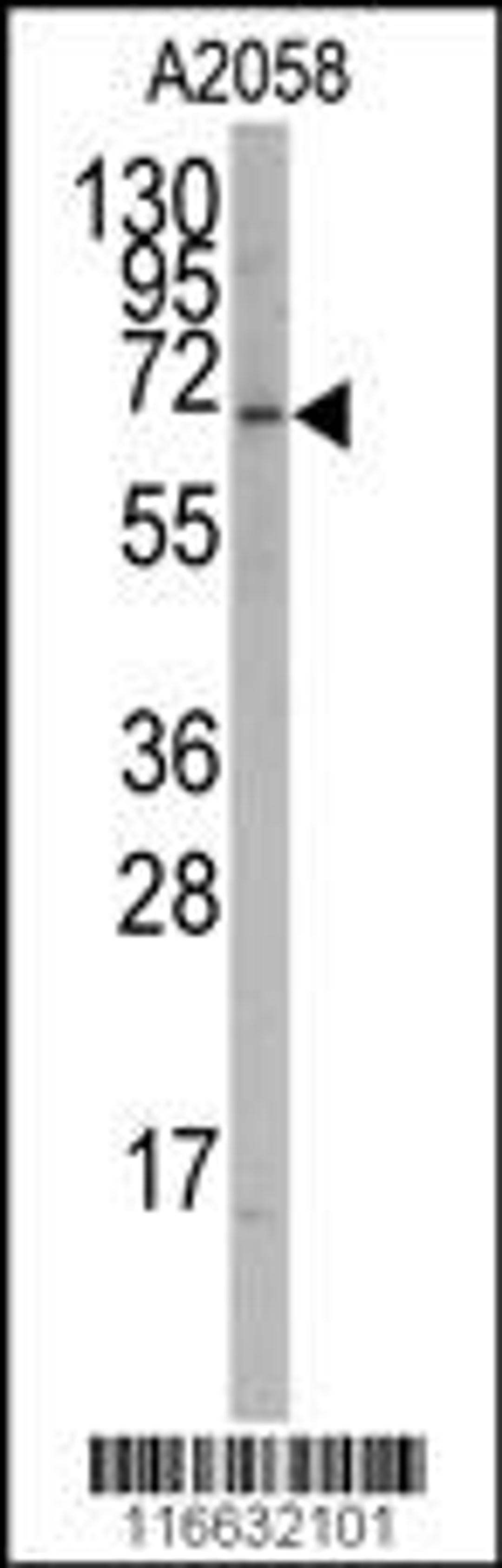 Western blot analysis of anti-RORA Antibody (T216) in A2058 cell line lysates (35ug/lane)