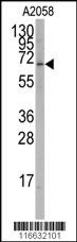 Western blot analysis of anti-RORA Antibody (T216) in A2058 cell line lysates (35ug/lane)