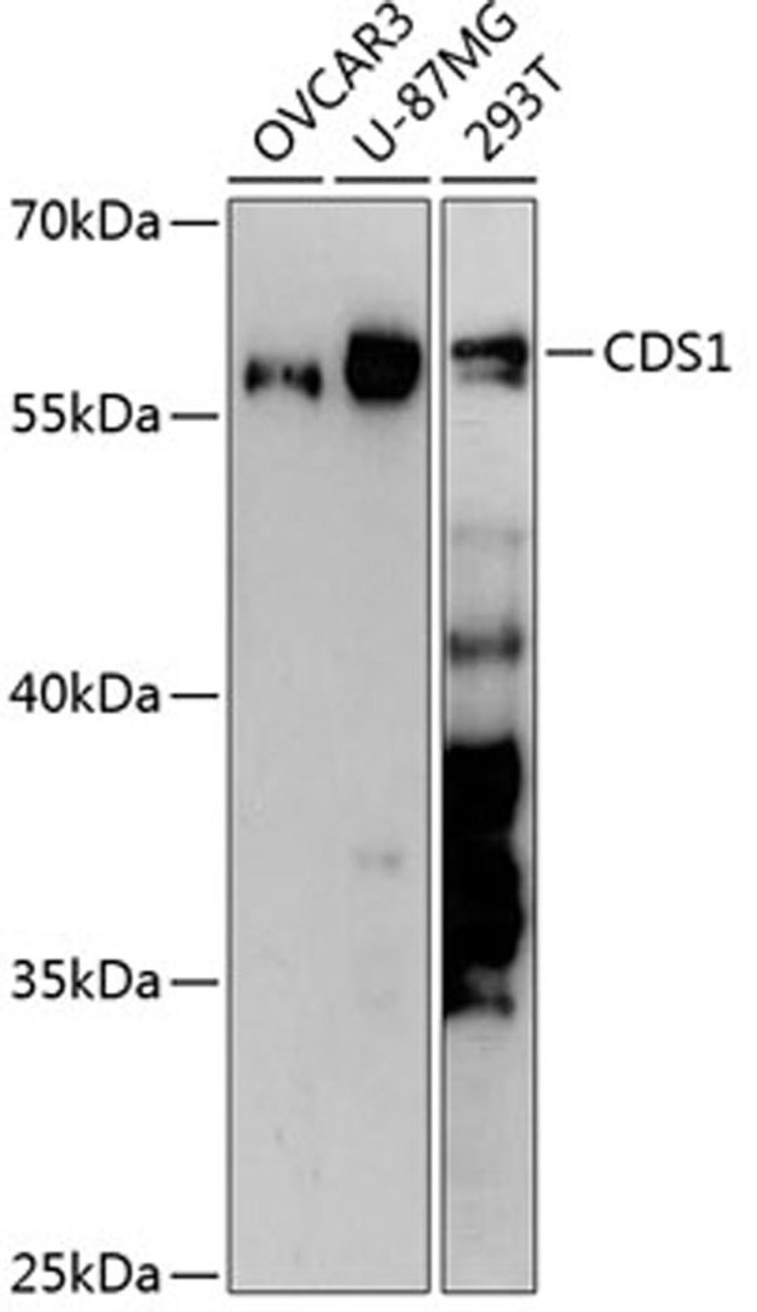 Western blot - CDS1 antibody (A13758)