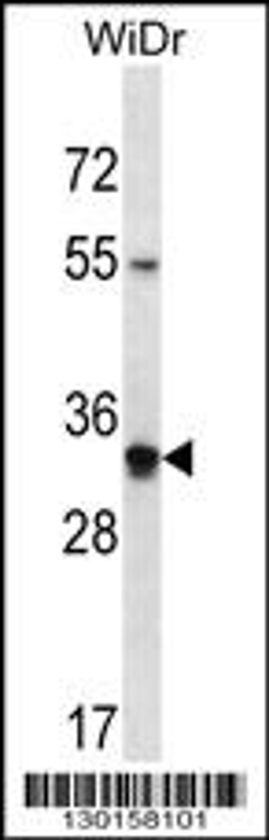 Western blot analysis in WiDr cell line lysates (35ug/lane).