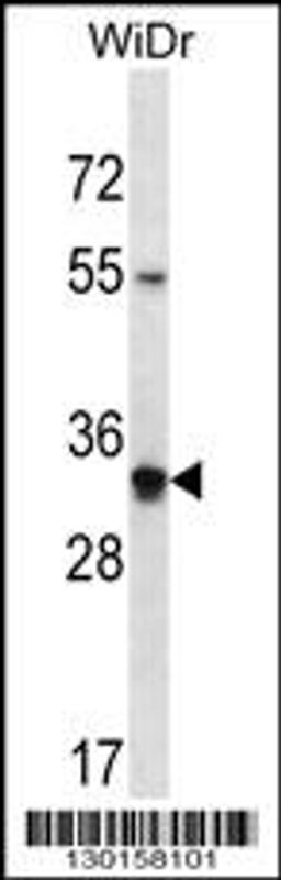 Western blot analysis in WiDr cell line lysates (35ug/lane).