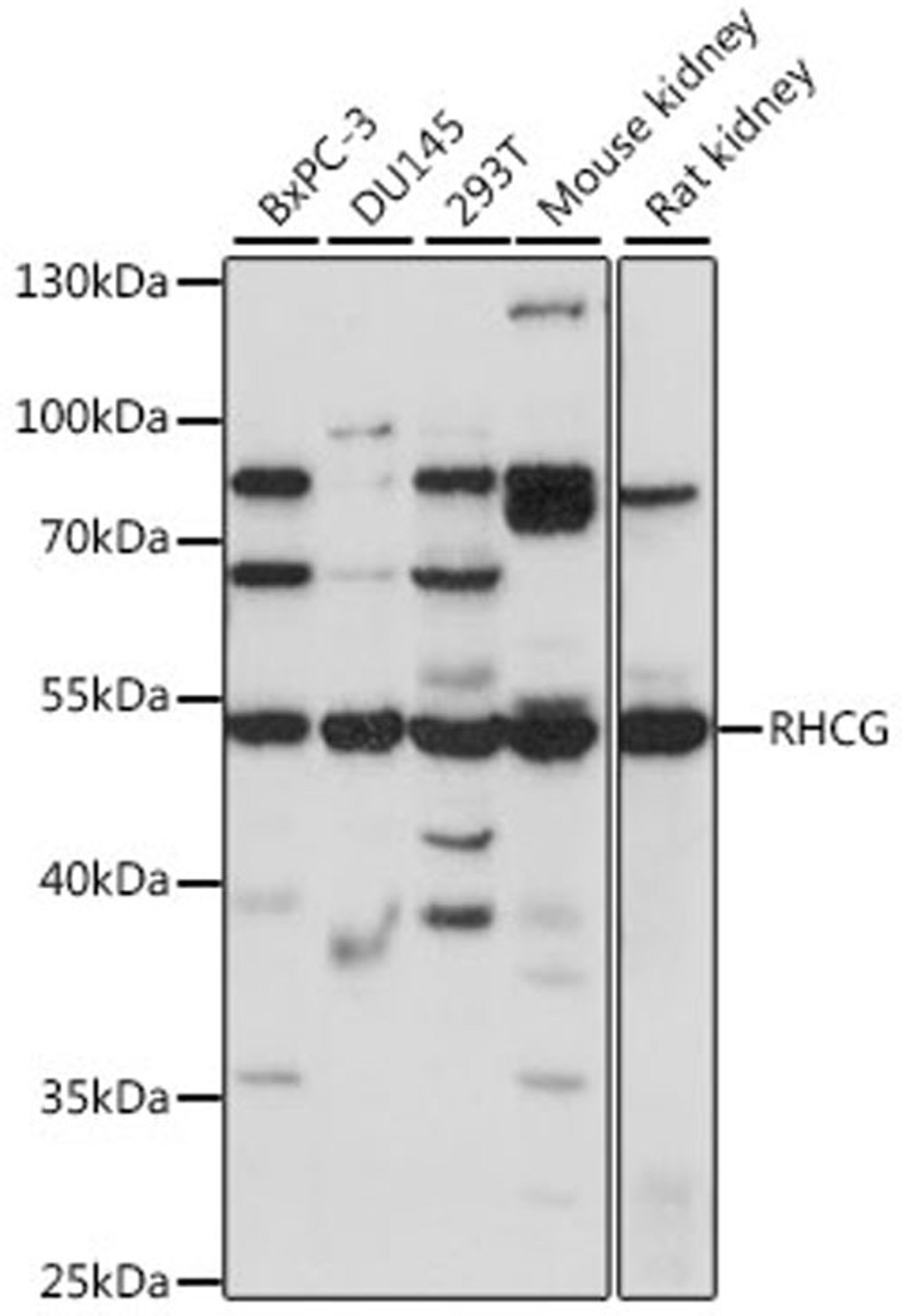 Western blot - RHCG antibody (A16124)