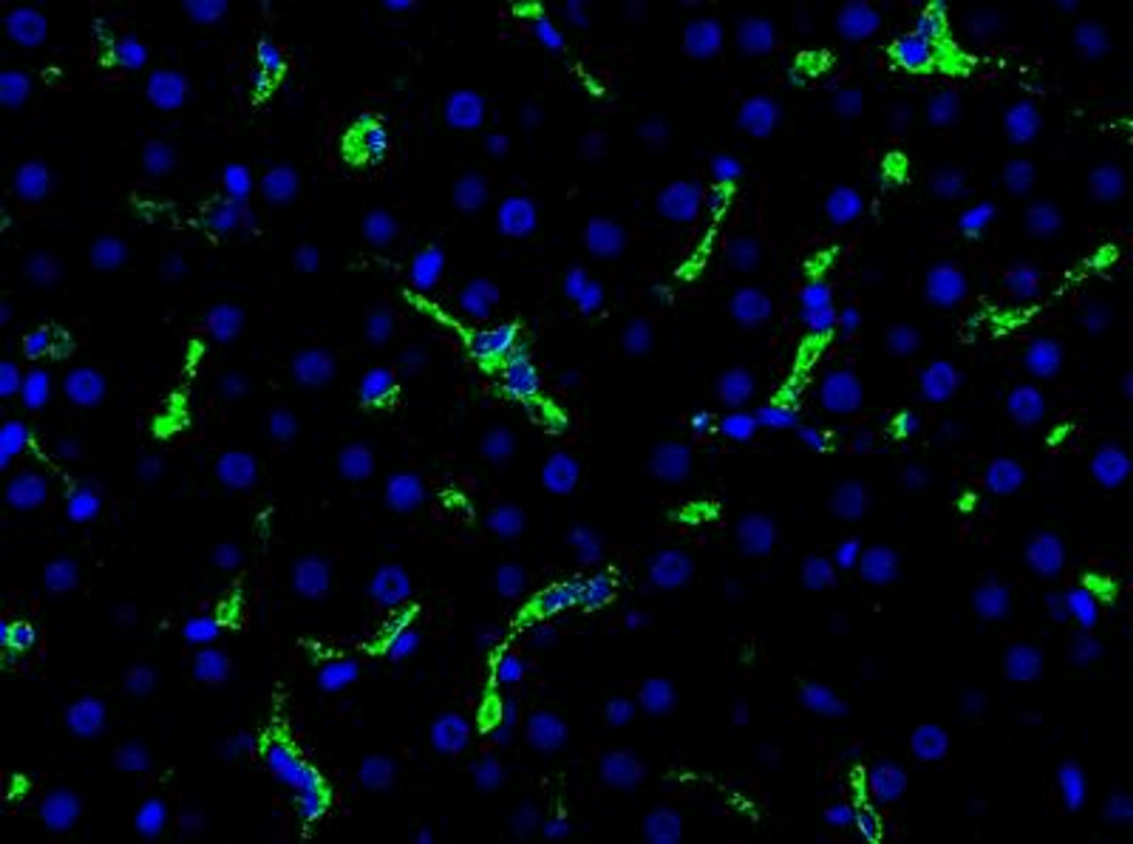 Immunocytochemistry/Immunofluorescence: CD163 Antibody (K20-T) [NBP1-30148] - CD163 immunolabelling on a representative human HCV liver biopsy section. Image provided by Victoria Gadd.