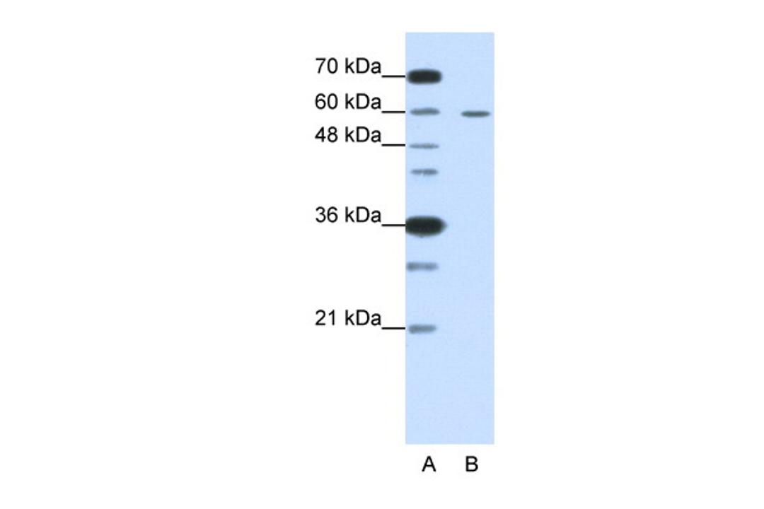 Antibody used in WB on Human HepG2 cells at 0.2-1 ug/ml.