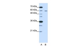 Antibody used in WB on Human HepG2 cells at 0.2-1 ug/ml.