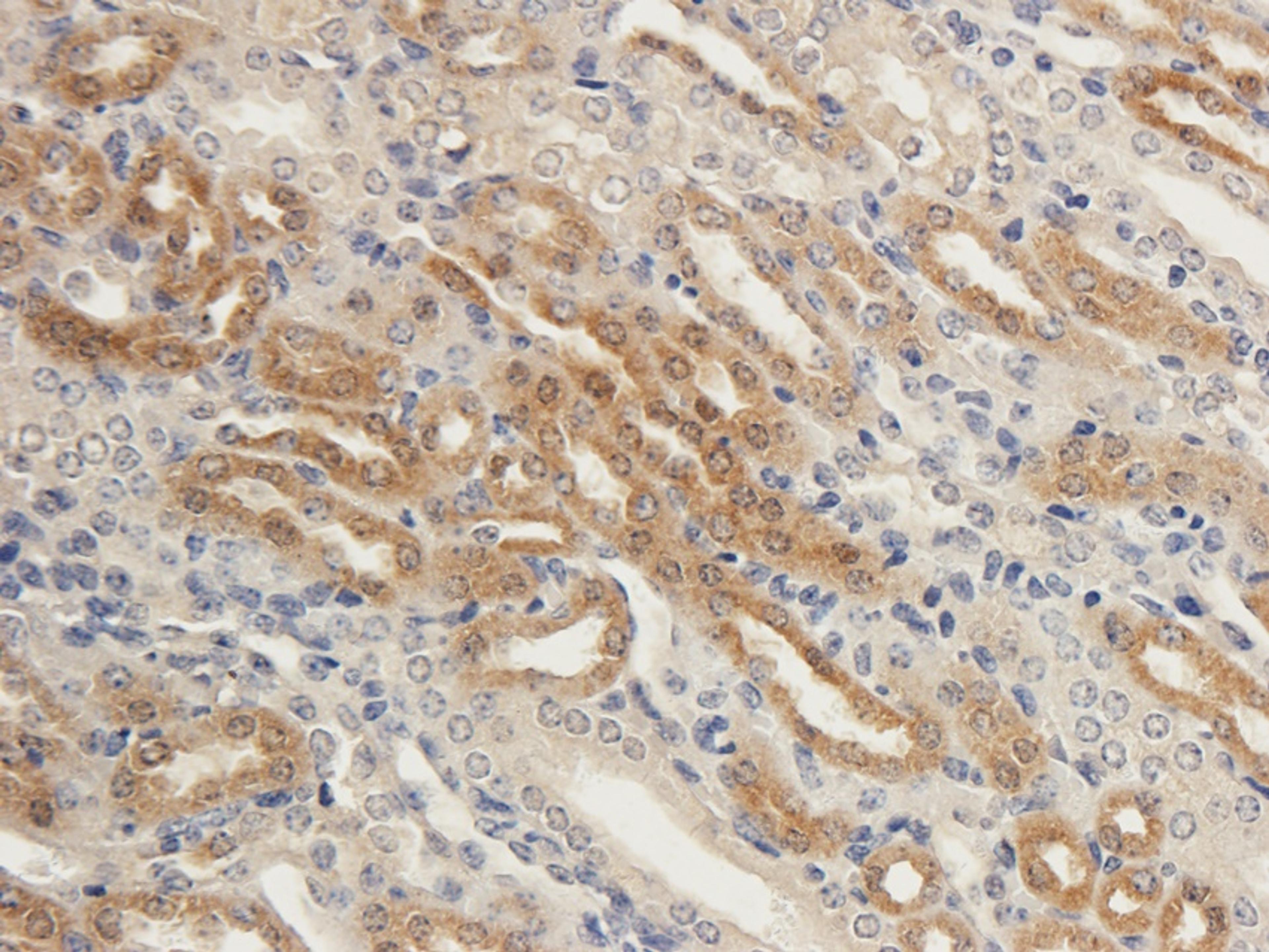 Immunohistochemical staining of paraffin embedded guinea pig kidney tissue using anti-ENaC Alpha (2.5 ug/ml)