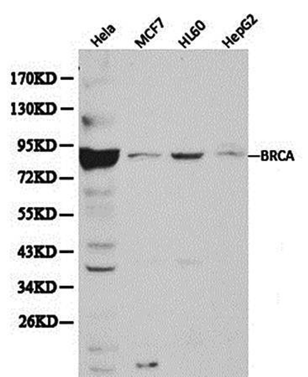 Western blot analysis of extracts of various cell line lysates using BRCA1   antibody