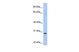 Antibody used in WB on Human HeLa at 0.2-1 ug/ml.