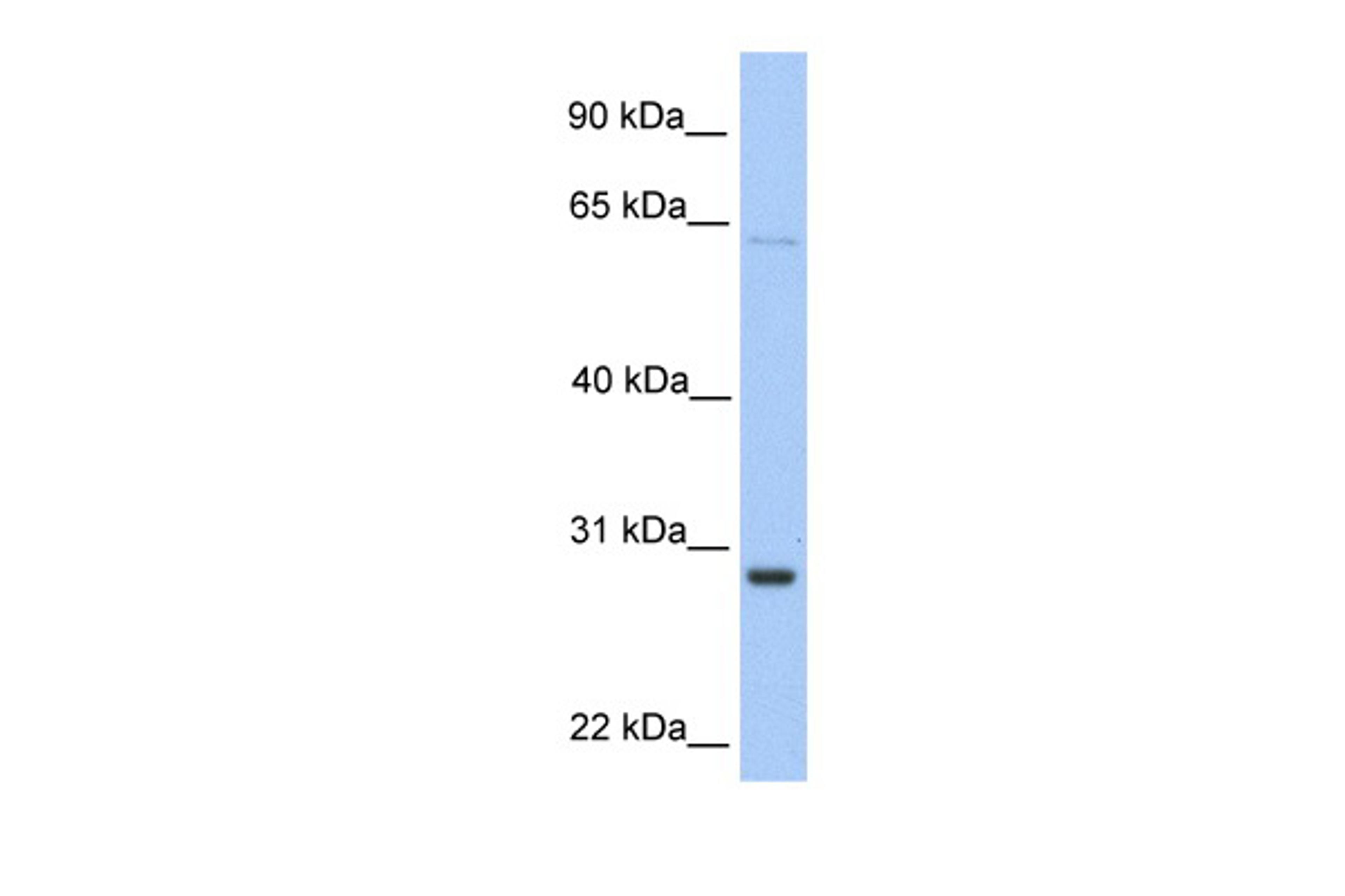 Antibody used in WB on Human HeLa at 0.2-1 ug/ml.