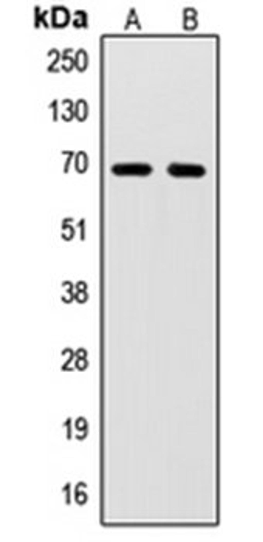 Western blot analysis of HL60 (Lane 1), Jurkat (Lane 2) whole cell lysates using SENP2 antibody