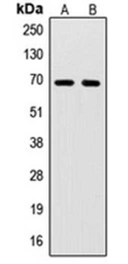 Western blot analysis of HL60 (Lane 1), Jurkat (Lane 2) whole cell lysates using SENP2 antibody