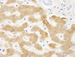 Detection of human C-Reactive Protein by immunohistochemistry.