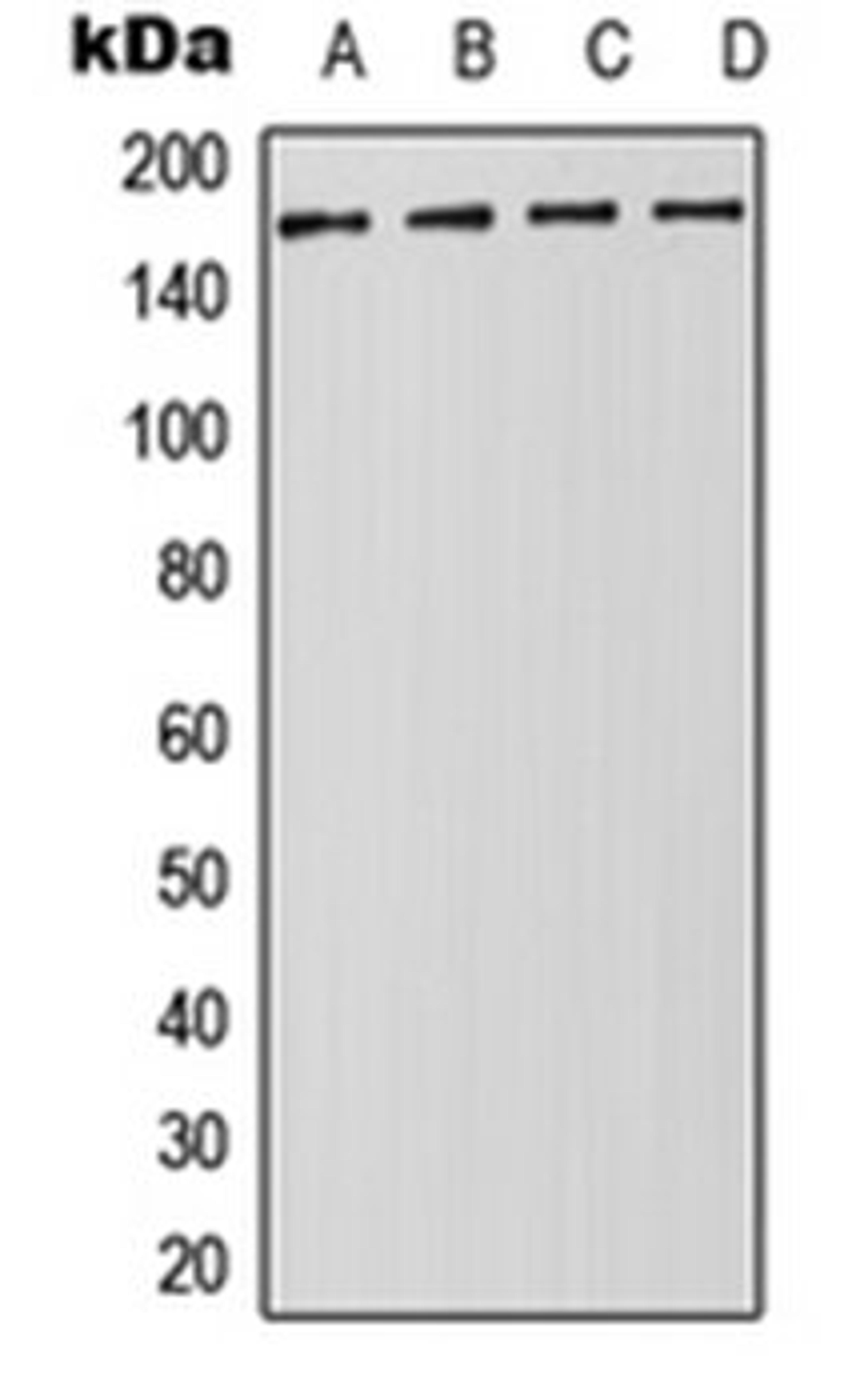 Western blot analysis of Jurkat (Lane 1), HeLa (Lane 2), NIH3T3 (Lane 3), PC12 (Lane 4) whole cell lysates using DROSHA antibody