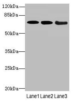 Western blot. All lanes: COL9A3antibody at 3.66ug/ml. Lane 1: K562 whole cell lysate. Lane 2: MCF-7 whole cell lysate. Lane 3: A549 whole cell lysate. Secondary. Goat polyclonal to rabbit IgG at 1/10000 dilution. Predicted band size: 64 kDa. Observed band size: 64 kDa. 