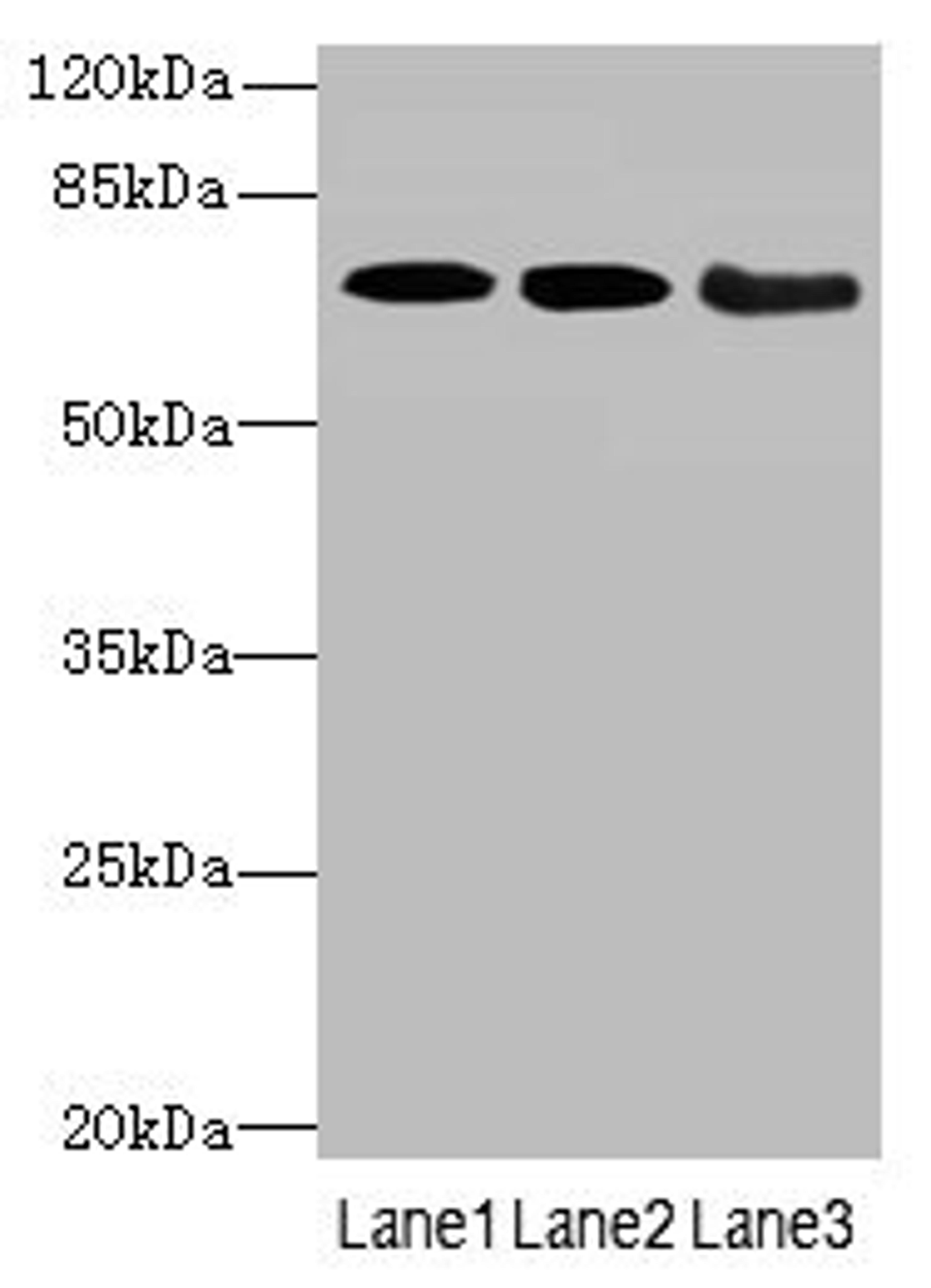 Western blot. All lanes: COL9A3antibody at 3.66ug/ml. Lane 1: K562 whole cell lysate. Lane 2: MCF-7 whole cell lysate. Lane 3: A549 whole cell lysate. Secondary. Goat polyclonal to rabbit IgG at 1/10000 dilution. Predicted band size: 64 kDa. Observed band size: 64 kDa. 
