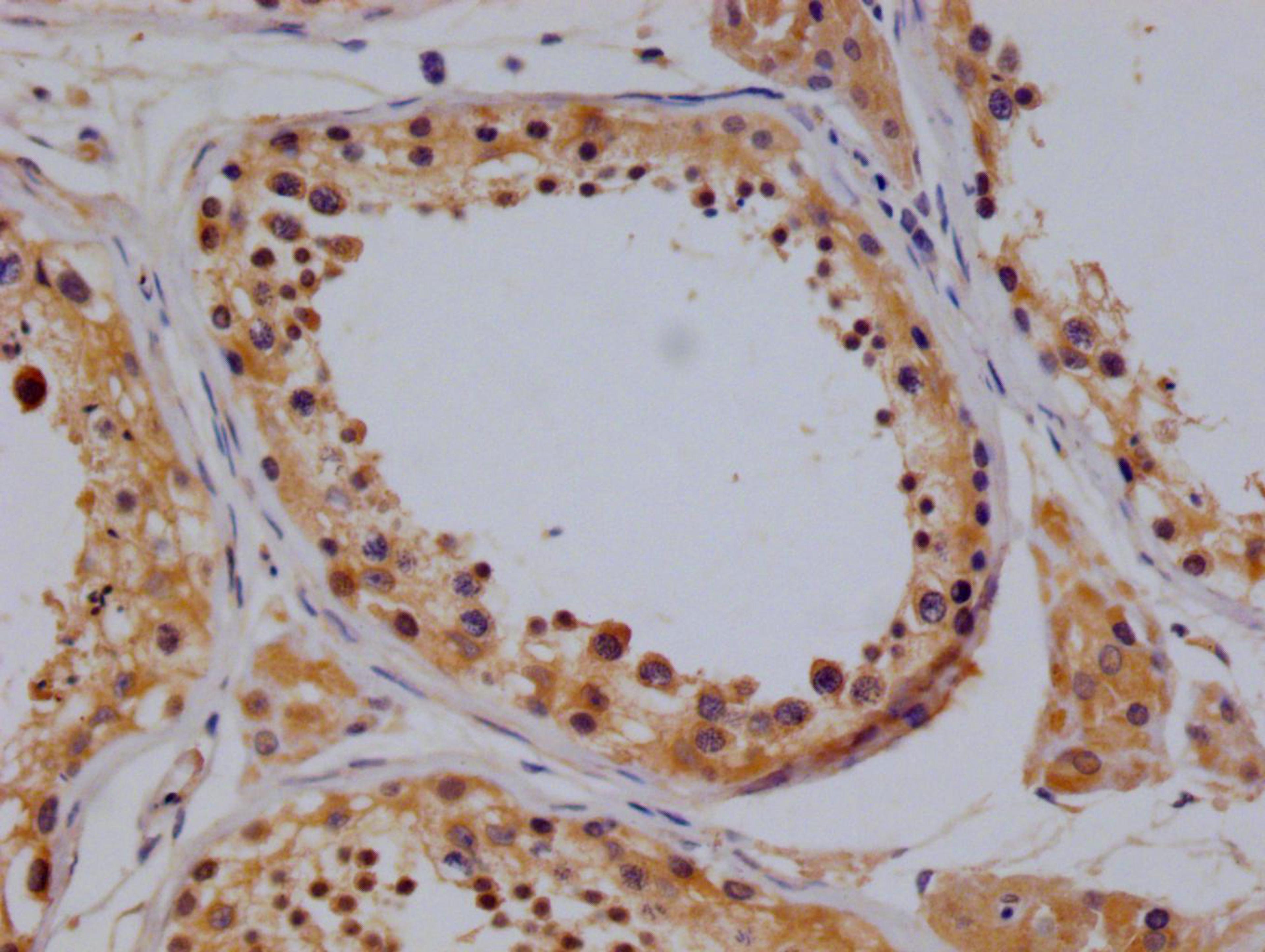 IHC image of CSB-RA932866A0HU diluted at 1:100 and staining in paraffin-embedded human testis tissue performed on a Leica BondTM system. After dewaxing and hydration, antigen retrieval was mediated by high pressure in a citrate buffer (pH 6.0). Section was blocked with 10% normal goat serum 30min at RT. Then primary antibody (1% BSA) was incubated at 4°C overnight. The primary is detected by a Goat anti-rabbit polymer IgG labeled by HRP and visualized using 0.05% DAB.