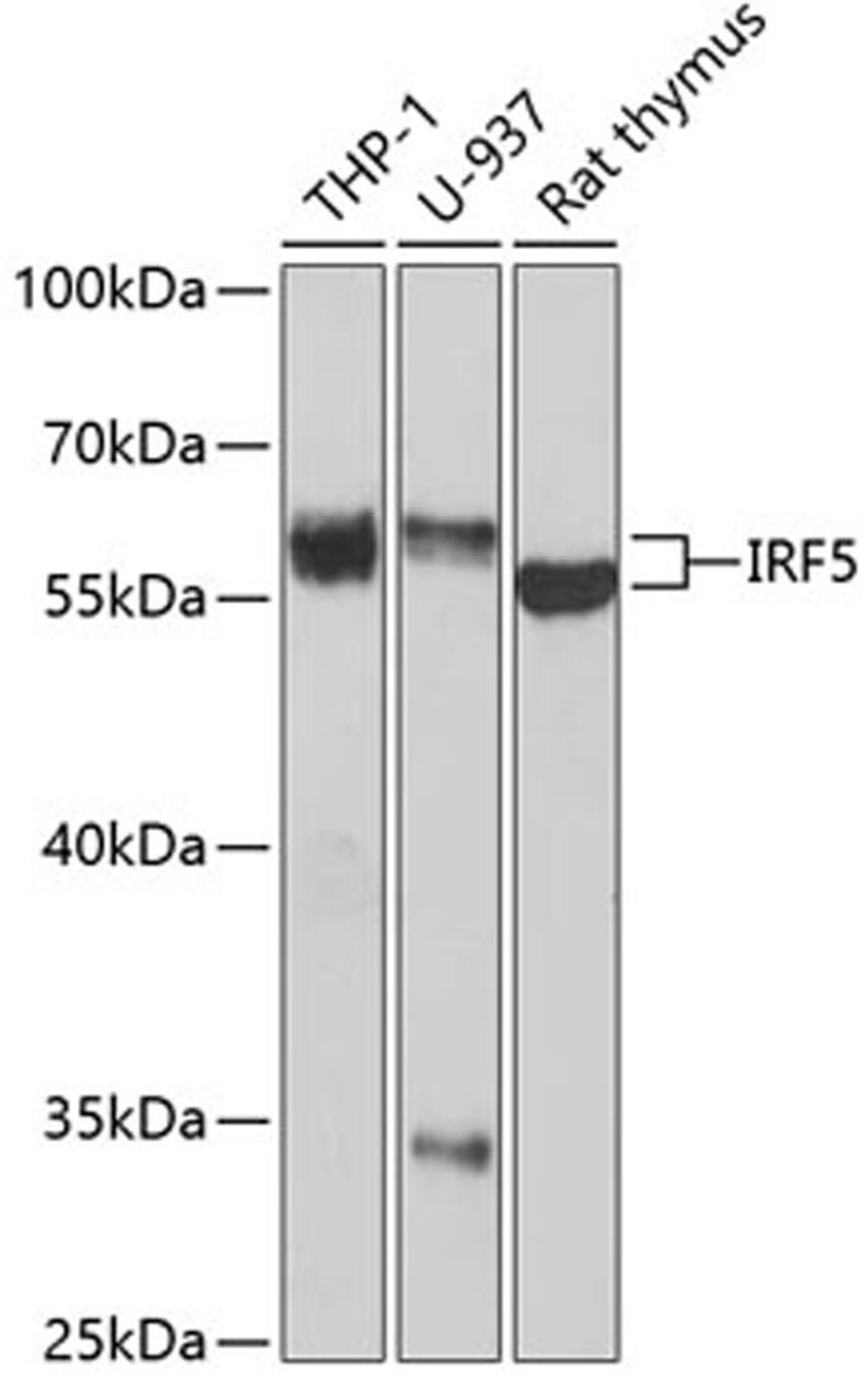 Western blot - IRF5 antibody (A1149)