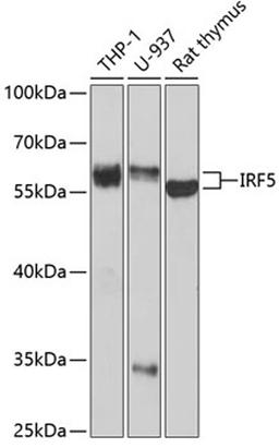 Western blot - IRF5 antibody (A1149)