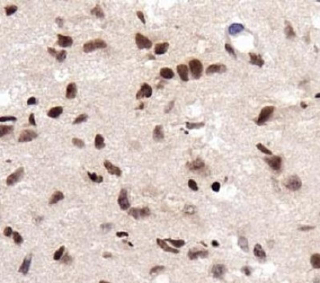 Immunohistochemistry: RCAN1 Antibody [NBP1-46852] - Immunohistochemical analysis of RCAN1 in human fetal brain.