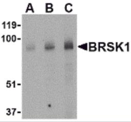 Western blot analysis of BRSK1 in human brain tissue lysate with BRSK1 antibody at (A) 0.5, (B) 1 and (C) 2 &#956;g/mL.