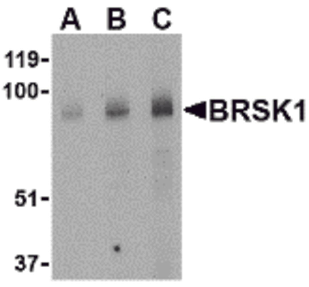 Western blot analysis of BRSK1 in human brain tissue lysate with BRSK1 antibody at (A) 0.5, (B) 1 and (C) 2 μg/mL.