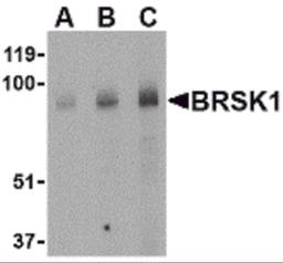 Western blot analysis of BRSK1 in human brain tissue lysate with BRSK1 antibody at (A) 0.5, (B) 1 and (C) 2 μg/mL.