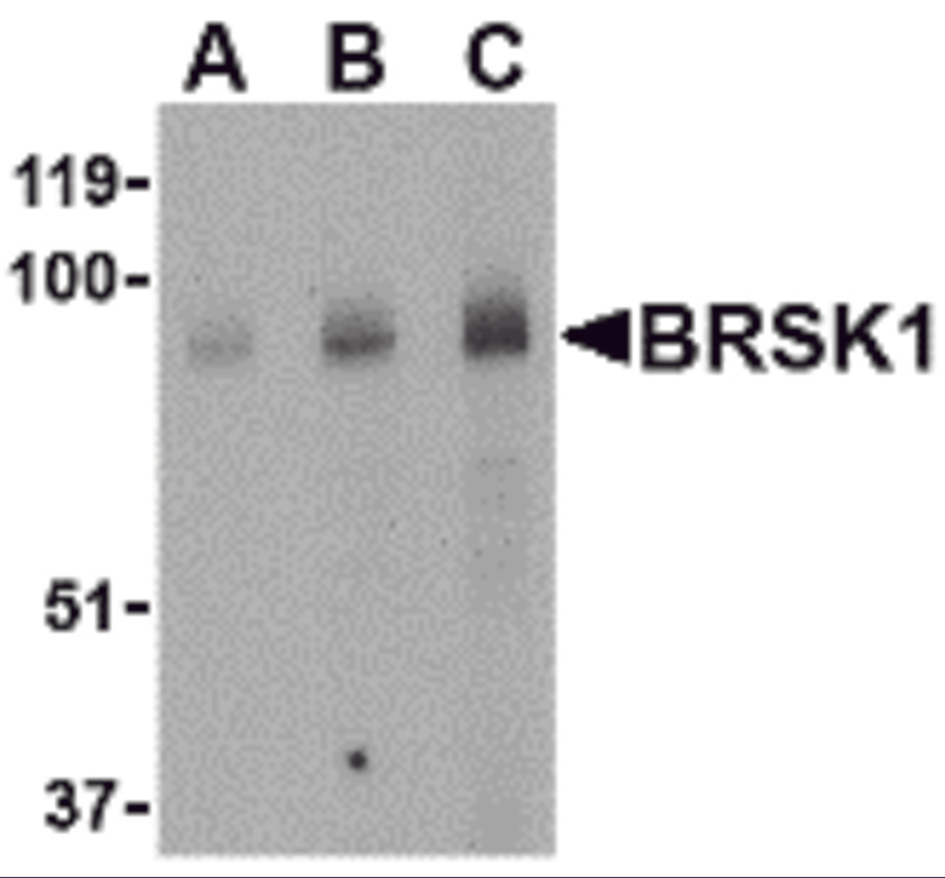 Western blot analysis of BRSK1 in human brain tissue lysate with BRSK1 antibody at (A) 0.5, (B) 1 and (C) 2 μg/mL.