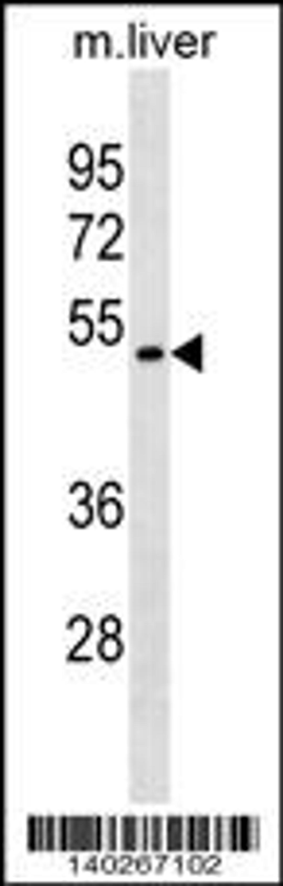 Western blot analysis in mouse liver tissue lysates (35ug/lane).