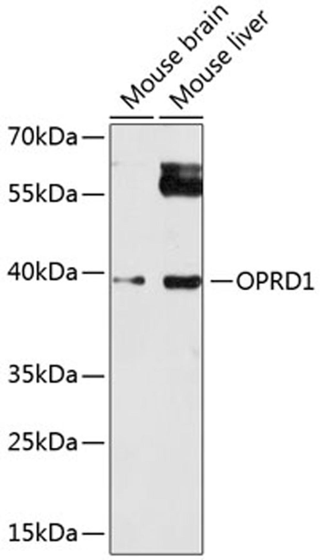 Western blot - OPRD1 antibody (A14207)