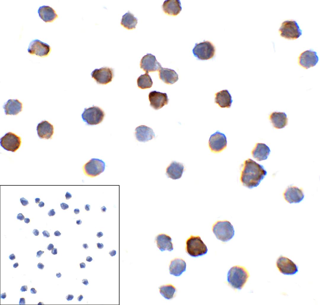 Immunocytochemistry of PD-1 in overexpressing HEK293 cells with PD-1 antibody at 10 &#956;g/mL. Corner Box: Immunocytochemistry in transfected 293 cells with control mouse IgG antibody at 10 &#956;g/mL.