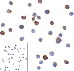 Immunocytochemistry of PD-1 in overexpressing HEK293 cells with PD-1 antibody at 10 &#956;g/mL. Corner Box: Immunocytochemistry in transfected 293 cells with control mouse IgG antibody at 10 &#956;g/mL.