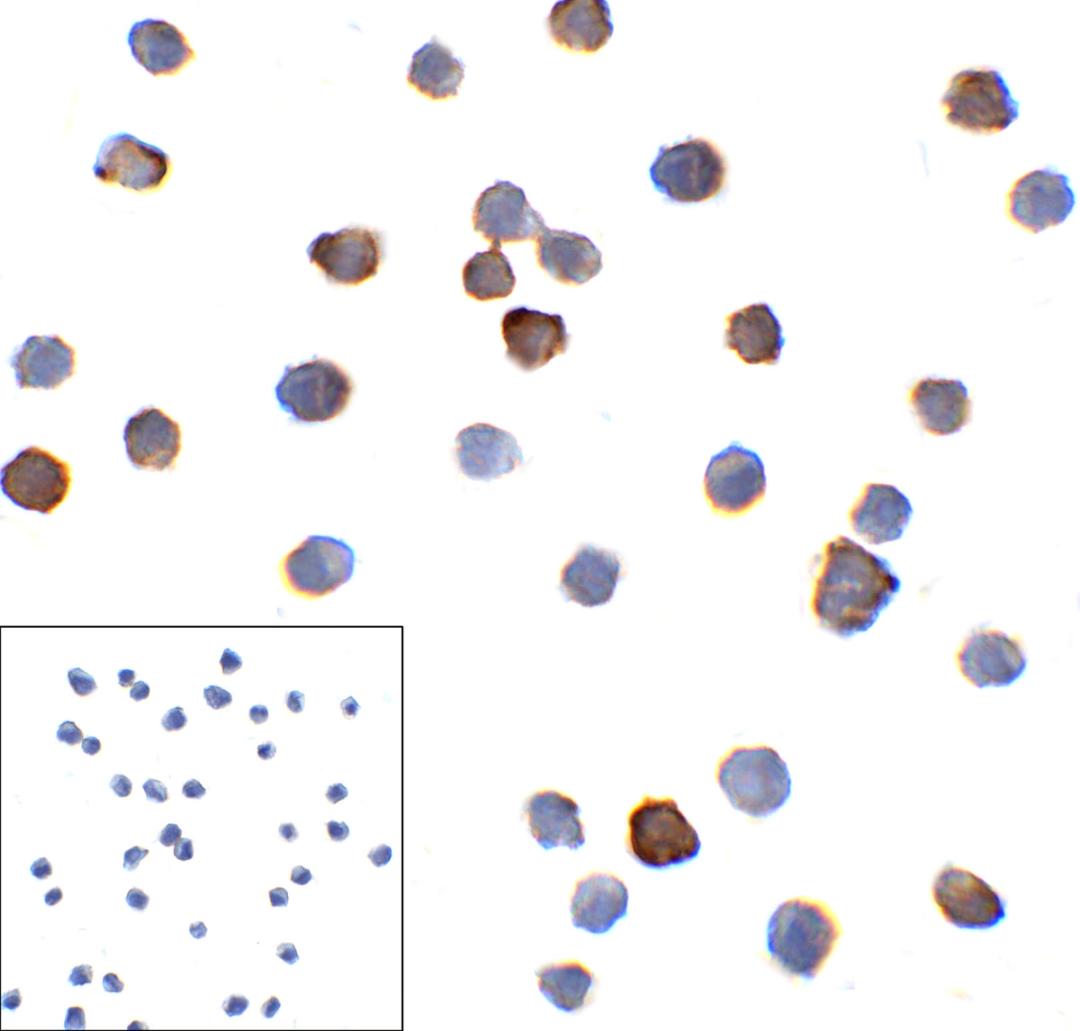Immunocytochemistry of PD-1 in overexpressing HEK293 cells with PD-1 antibody at 10 μg/mL. Corner Box: Immunocytochemistry in transfected 293 cells with control mouse IgG antibody at 10 μg/mL.