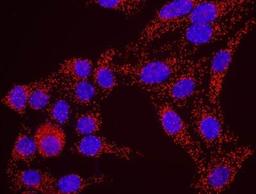 Proximity Ligation Assay: Claspin Antibody [NB100-247] - Secondary-conjugate Duolink II PLA in Hela cells. goat anti-human RAD17 (NB100-272) and rabbit anti-human Claspin (NB100-247). Image merged from DAPI (2ms) and Texas Red (200ms) exposures, 40X magnification.